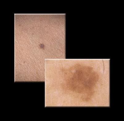 Borroni Prof. Giovanni - Immagine 2