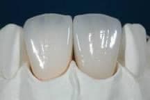 Dental Isernia - Immagine 1