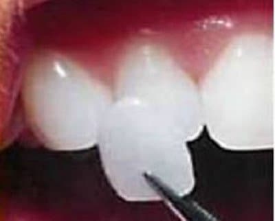 Dental Labor Laboratorio Odontotecnico - Immagine 2