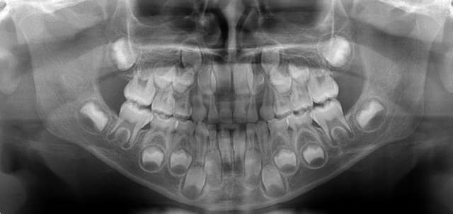 Dentalrad - Immagine 1