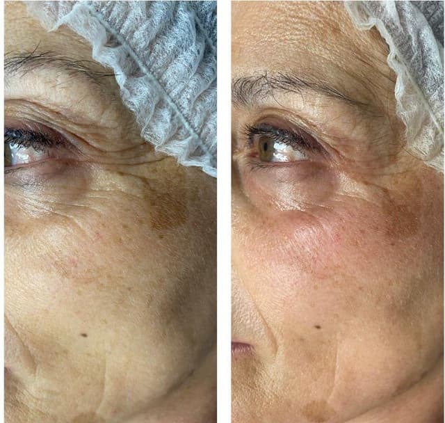 Elisir Istituto di Bellezza - Immagine 1