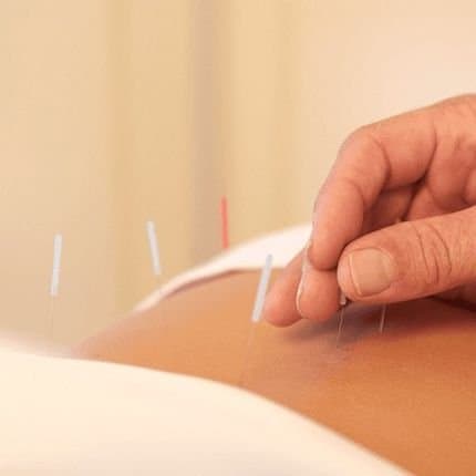 Fontanini Dr. Fulvio - Agopuntura - Immagine 1