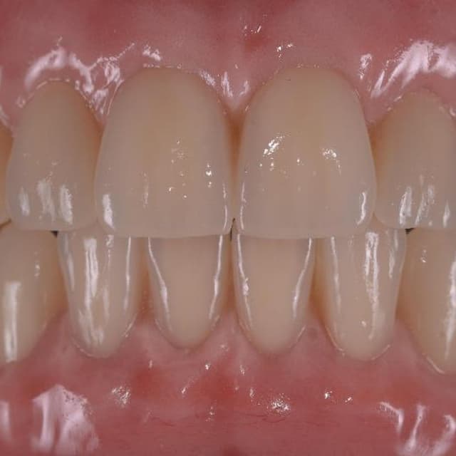 Montanari Elio Laboratorio Odontotecnico - Immagine 2