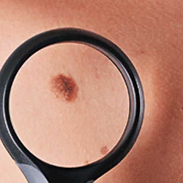 Mosca Dott.ssa Marisa Dermatologo - Immagine 1