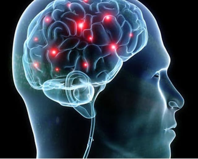 Pirolo Dott. Domenico Neurologo - Immagine 2