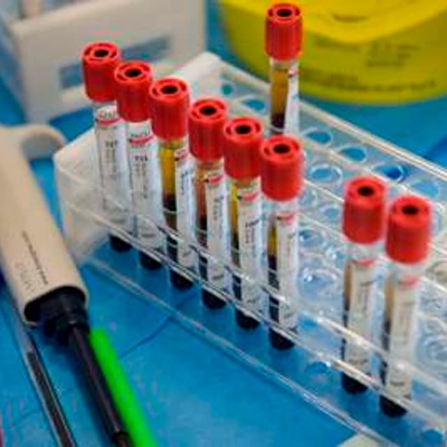 Albeggiani Laboratorio Analisi Cliniche - Immagine 1