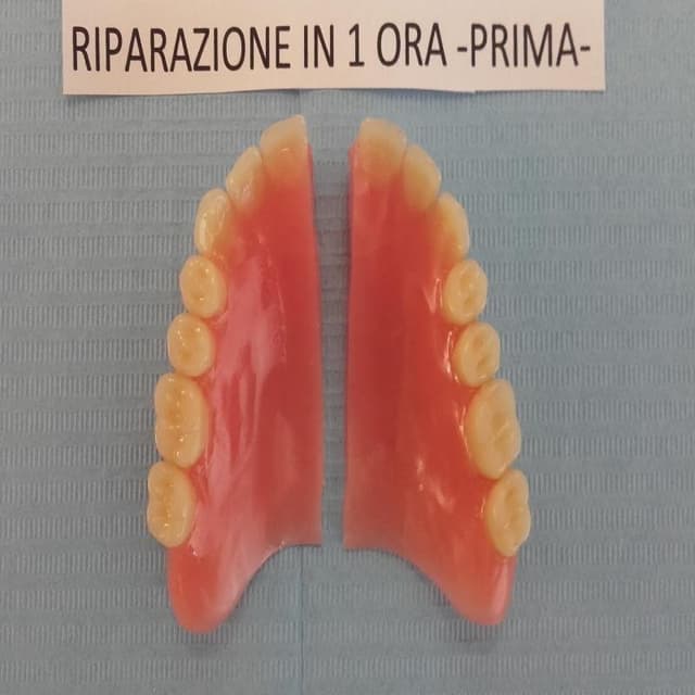 A.T.M. Laboratorio Odontotecnico-Riparazioni Protesi Dentali Immediate - Immagine 2