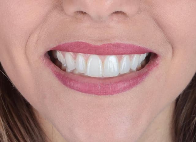 Centro Odontoiatrico Aufiero Dr. Giovanni - Immagine 2