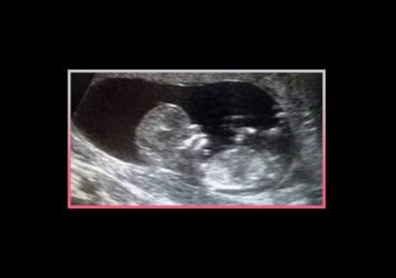 Di Francesco D.ssa Flavia Specialista in Ostetricia e Ginecologia zona Anagnina - Immagine 2