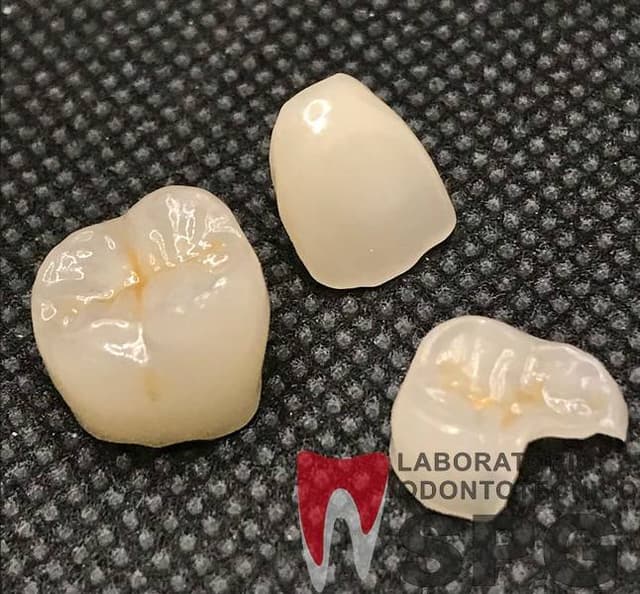 Laboratorio Odontotecnico Spg di Giacomini - Immagine 1