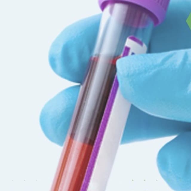 Labotek Analiticals - Laboratorio Analisi e Poliambulatorio - Immagine 2