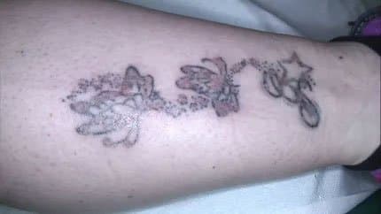 Melani Lucilla Medico Chirurgo Specialista in Dermatologia - Immagine 2