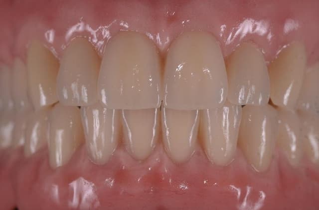 Montanari Elio Laboratorio Odontotecnico - Immagine 1