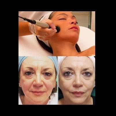 Teta Medical Fitness - Immagine 2