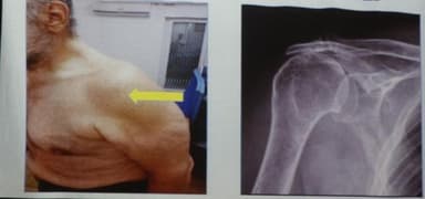 Fisioterapia San Cristoforo